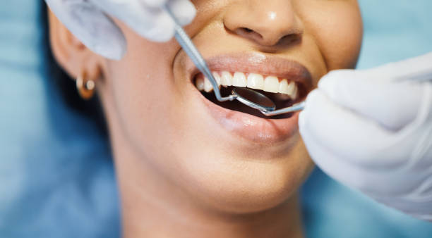 Best Emergency Tooth Extraction  in Fort Lee, VA